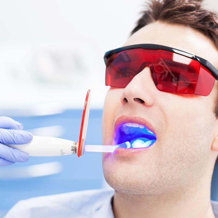 Cavity Detection System - Dental Technology